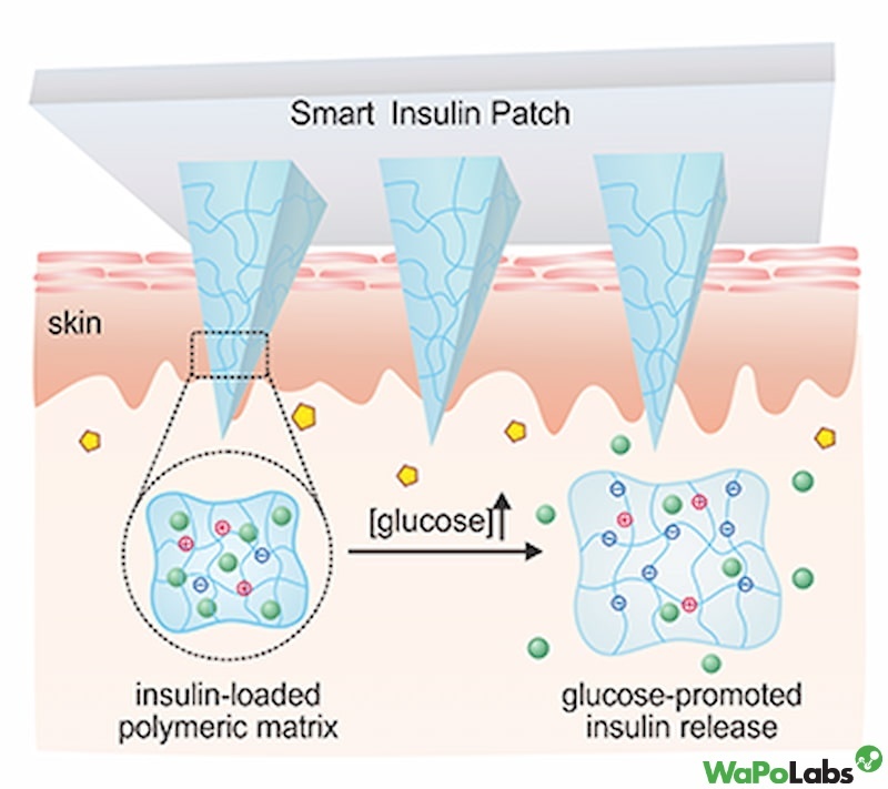 How Does the Diabetes Patch Work?