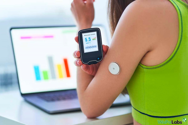 Continuous glucose monitoring cost?