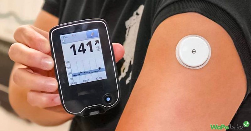 How Much Does Continuous Glucose Monitoring Cost?