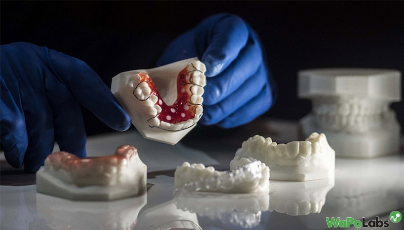 3D Printing for Dental: Prominent Benefits and Applications